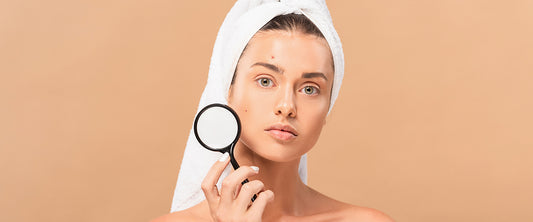 Acne Prone Skincare Treatment